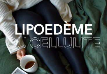 Lipoedème ou cellulite