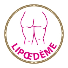 Informations générales sur le lipœdème